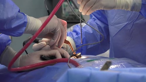 Chirurgie de la colonne vertébrale