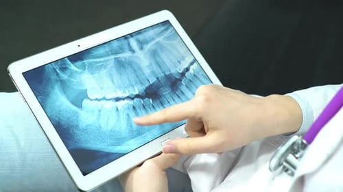 Close-up of Doctor Examining Dental X-Ray on Tablet
