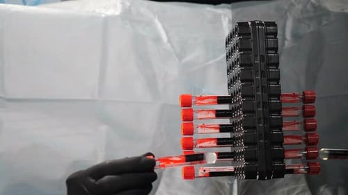 Blood Samples Being Organized in a Medical Lab