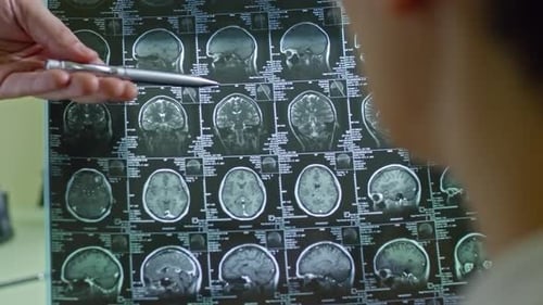 Doctor Explaining CT Scan of Brain