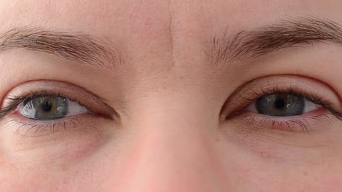 Eye 5