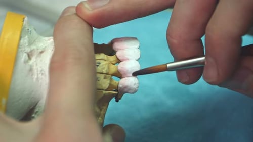 Dental Professional Working on Dental Mold Model