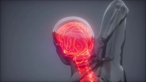 Backache in Back Bones