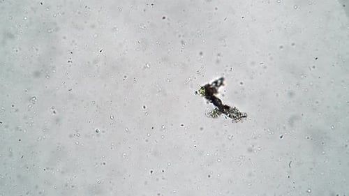 Dos infusorios se alimentan de algas en un microcosmos de bacterias