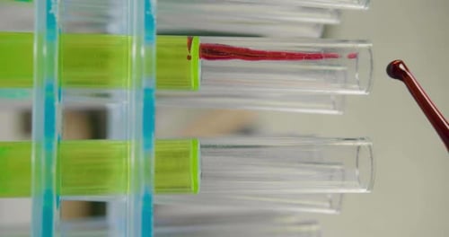 Research in the Field of Immunology Drops of Infected Blood Fall Into a Test Tube with a Solution