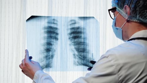 Doctor Examines X-Ray in Hospital Setting