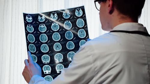 Doctor Examining Brain Scan in Exam Room