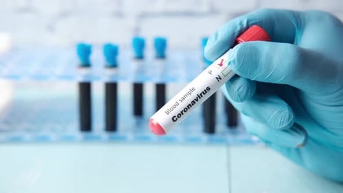 Gloved Hand Holds Coronavirus Blood Test Close Up