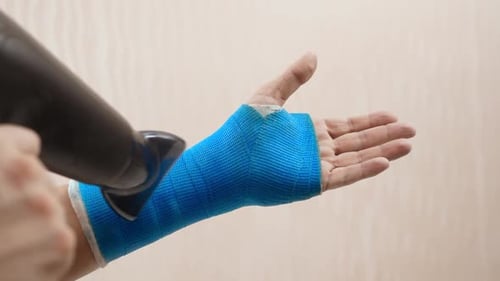 Adult Drying Arm Cast with Hair Dryer
