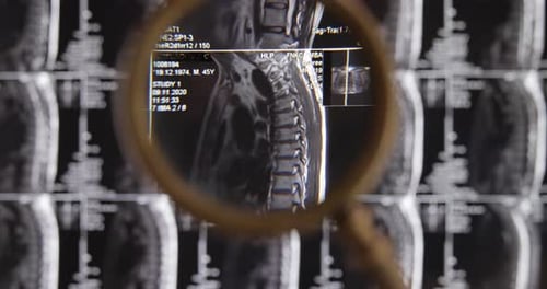 Close Up of Spine X-Rays Magnified