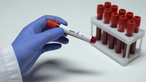 Gloved Hand Holding SARS Positive Blood Sample