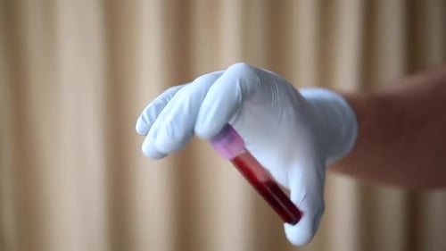 Blood Sample Held by Gloved Hand in Lab