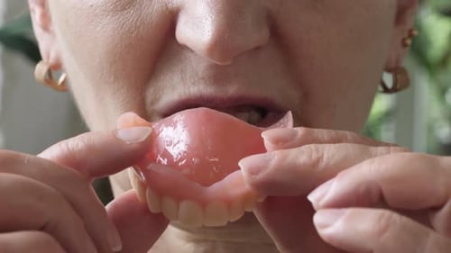 Woman Inserts Dentures into Mouth, Close Up