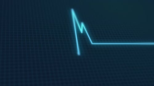 Digital EKG Pulse Monitor Line Animation