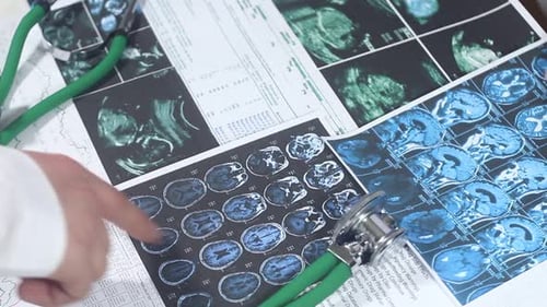 Doctors Analyze Brain Scan Images in Office