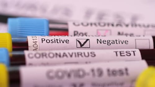 COVID-19 Blood Sample Vials With Positive Results