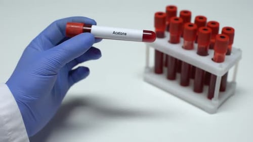 Acétone, médecin montrant un échantillon de sang dans un tube, recherche en laboratoire, bilan de santé
