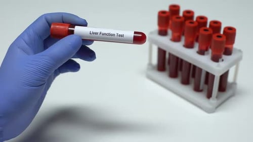 Liver Function, Doctor Shows Blood Sample in Tube, Lab Research, Health Checkup