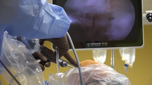 Surgeon Performing Arthroscopic Knee Surgery in Hospital