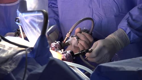 Bariatric Surgery or Gastric Bypass Surgery 3