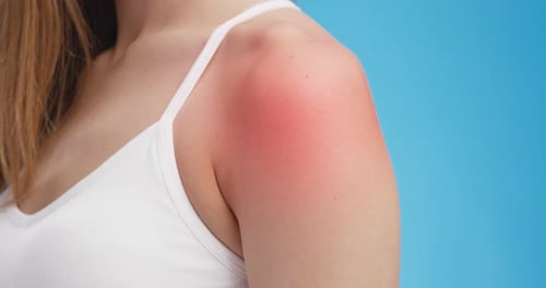 Close Up Shot of Sore Female Shoulder with Red Inflamed Pulcating Spot, Blue Background
