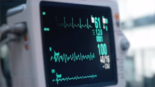 Heart Rate Monitor in Hospital Theater. Medical Vital Signs Monitor Instrument in a Hospital