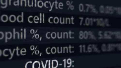 Retro Pixelated Medical Data Screen Displaying COVID-19 Result