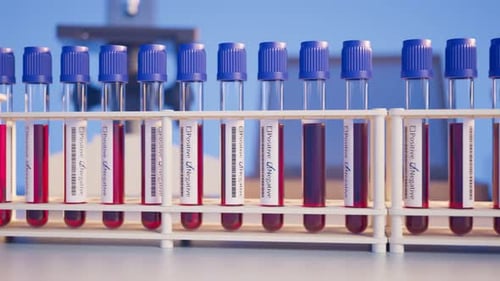 Animated Blood Test Tubes in Medical Lab