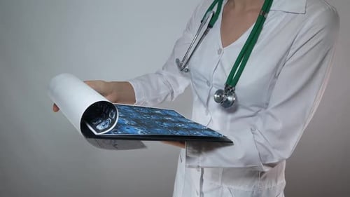 Medical Professional Holding MRI Scan on Clipboard