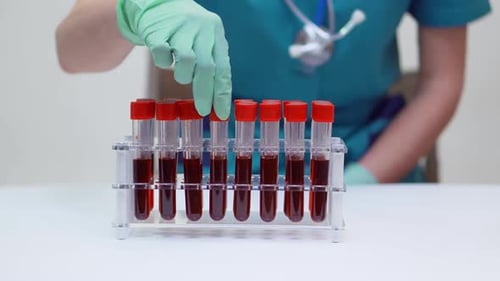 Medical Professional Analyzing Blood Samples in Test Tubes