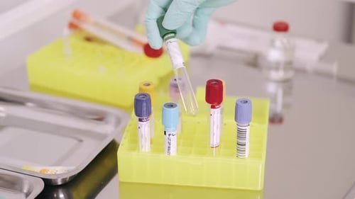 Medical test tubes in a laboratory setting
