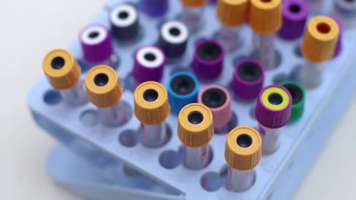 Unrecognizable Scientist Taking Test Tube with Liquid in Laboratory, Close-up.