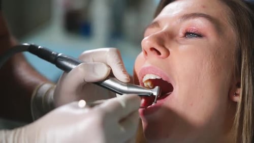 Tooth Polishing in Dental Clinic