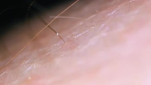 Macro View of Human Skin and Hair