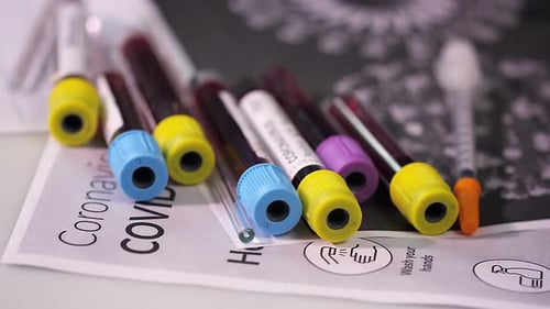 Scientific Dropper Experiment in Laboratory Setting