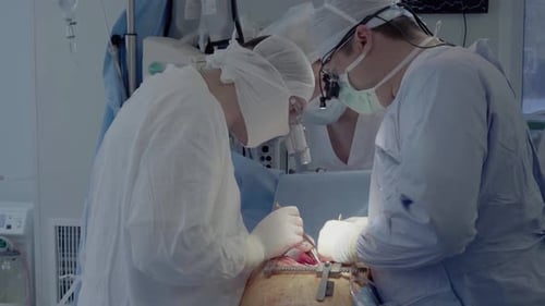 Das medizinische Personal der Operationseinheit führt Herzoperationen durch