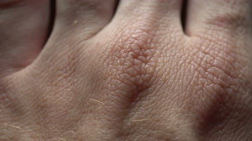 Fondo de piel humana macro
