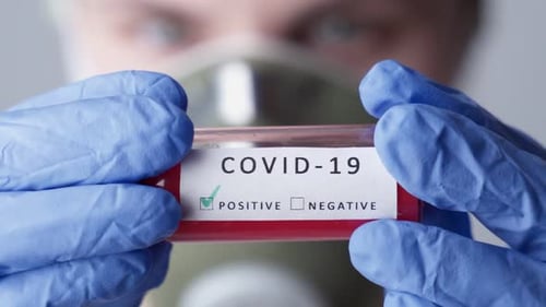 Positive COVID-19 Test Held by Doctor