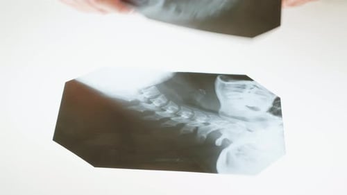 Examining Neck X-Rays in a Bright Room