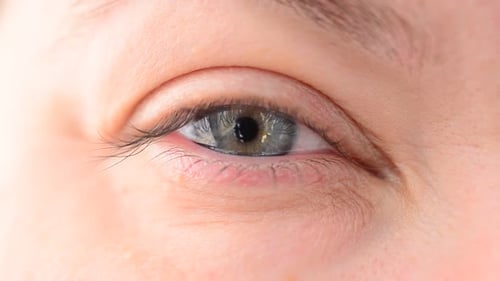 Auge 3