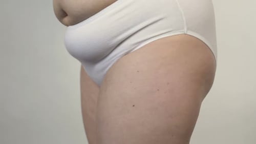 Cellulite on Woman's Buttocks, Overweight Lady Posing for Camera, Obesity