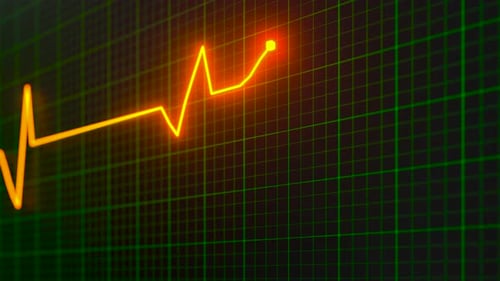 Heartbeat line reflecting on the monitor.