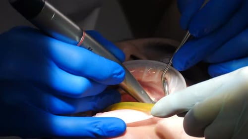 Close Up Dentistry Work On Patient's Teeth