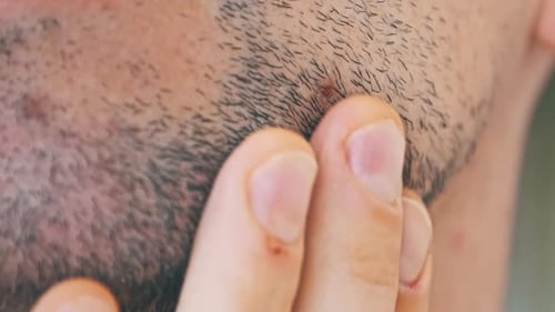 Male Bristle Closeup Young Man Touching By Hand the Stubble on His Face