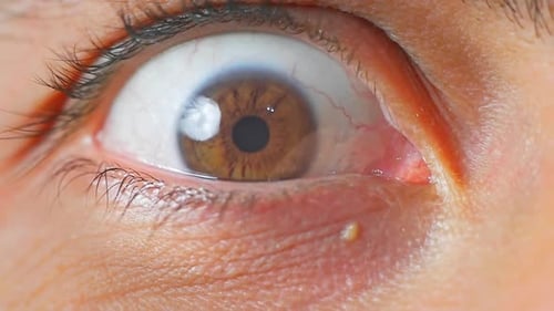 Close Up of Human Eye with Red Veins