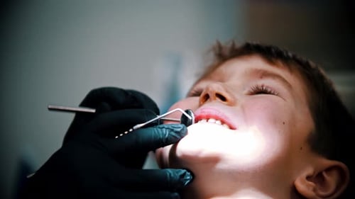 A Little Boy with Damaged Baby Teeth Having a Treatment in Modern Dentistry - the Dental