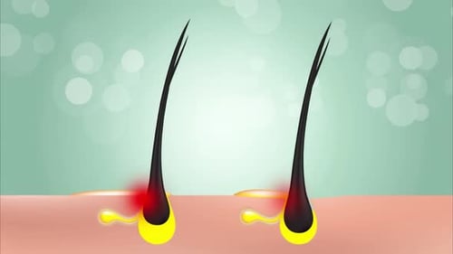 Animated Hair Follicle Health and Treatment Infographic