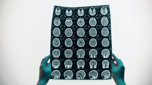 Brain Scan Held Up for Medical Analysis