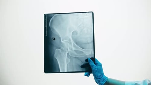 Primer plano de radiografía de cadera pélvica
