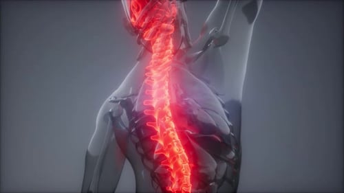 Backache in Back Bones